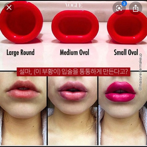 Full lips device - Picture 3 of 4